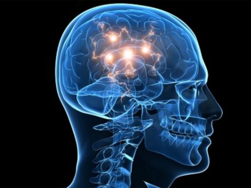 epilepsia-brain